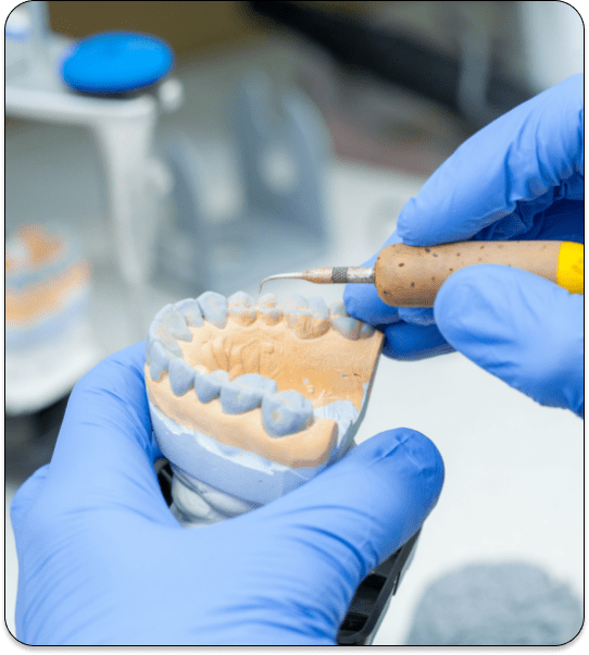 denture model