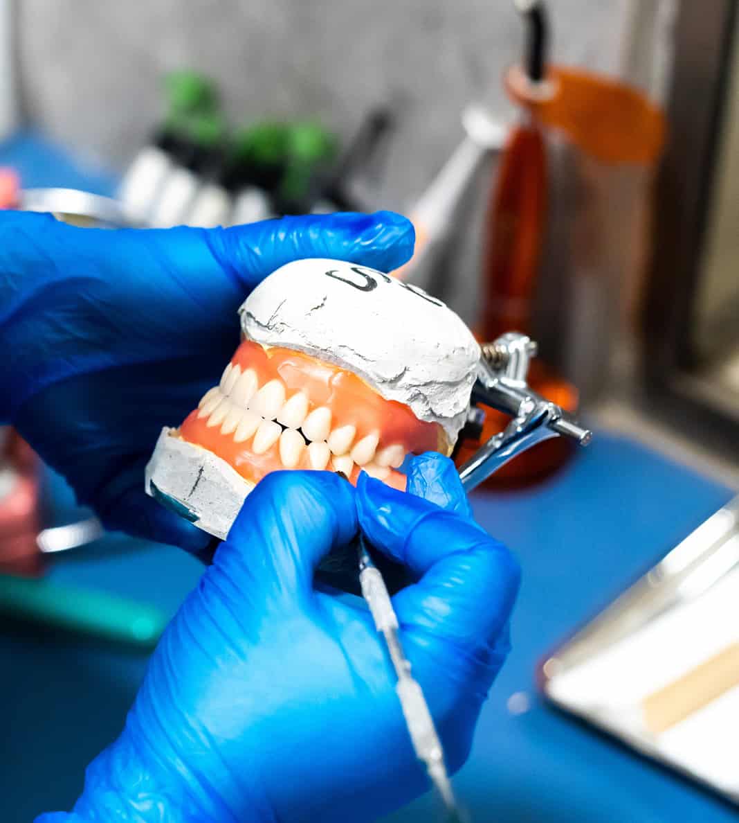 denture repair and reline clinic ottawa_1