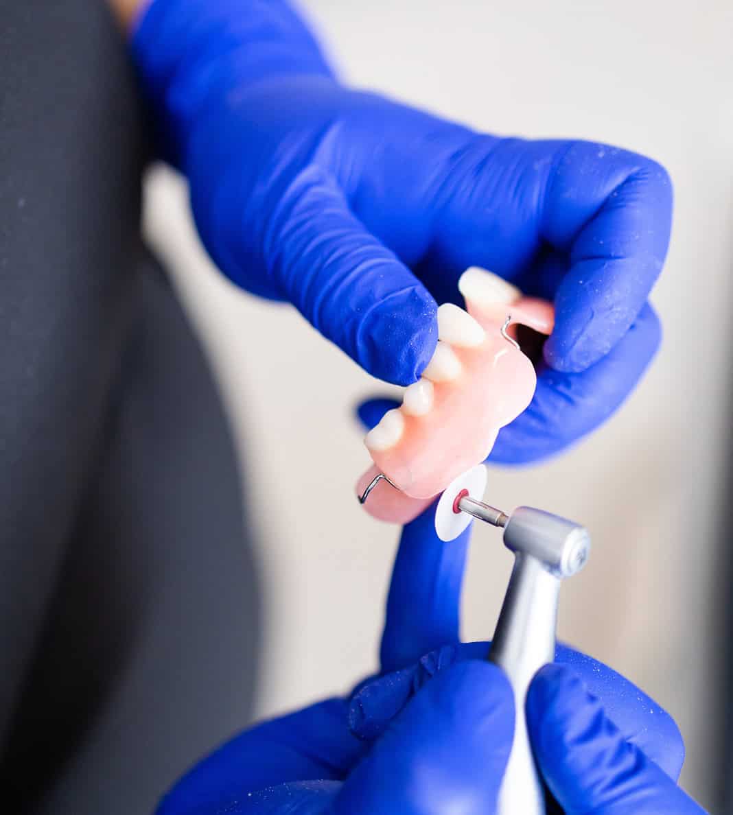 denture repair and reline service ottawa_1